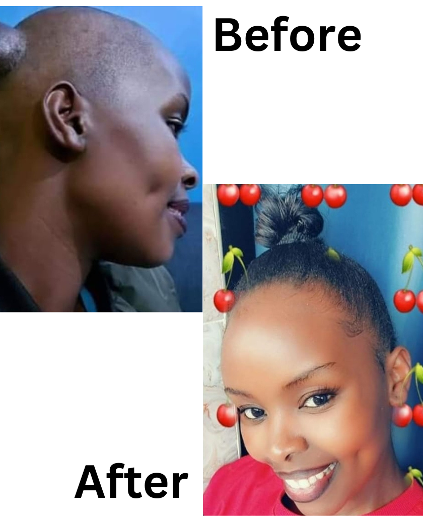 Beforeandafter